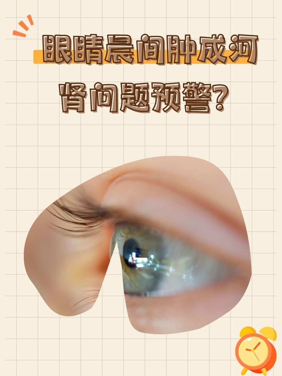 上眼皮浮肿要警惕三种病百科在线