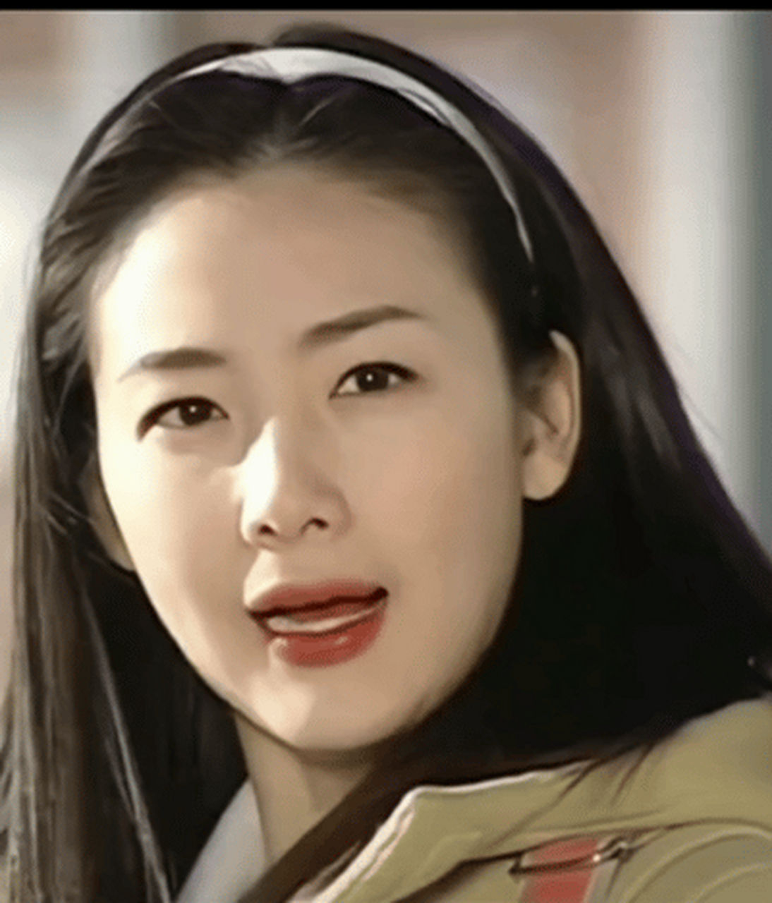 崔智友这是完全失败了呀 医美痕迹太明显了