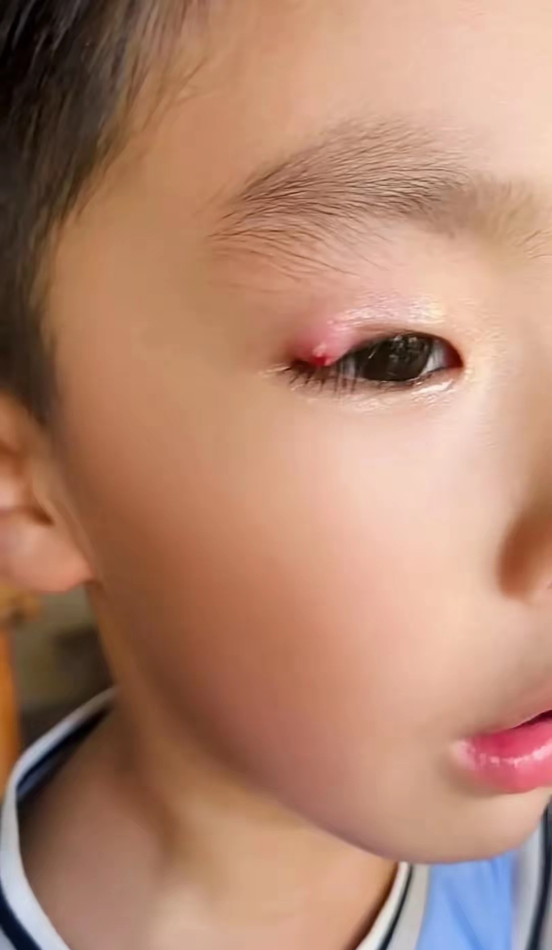 样子,我们从小到大也没经历过,家人们这对小孩眼睛以后视力有影响吗?