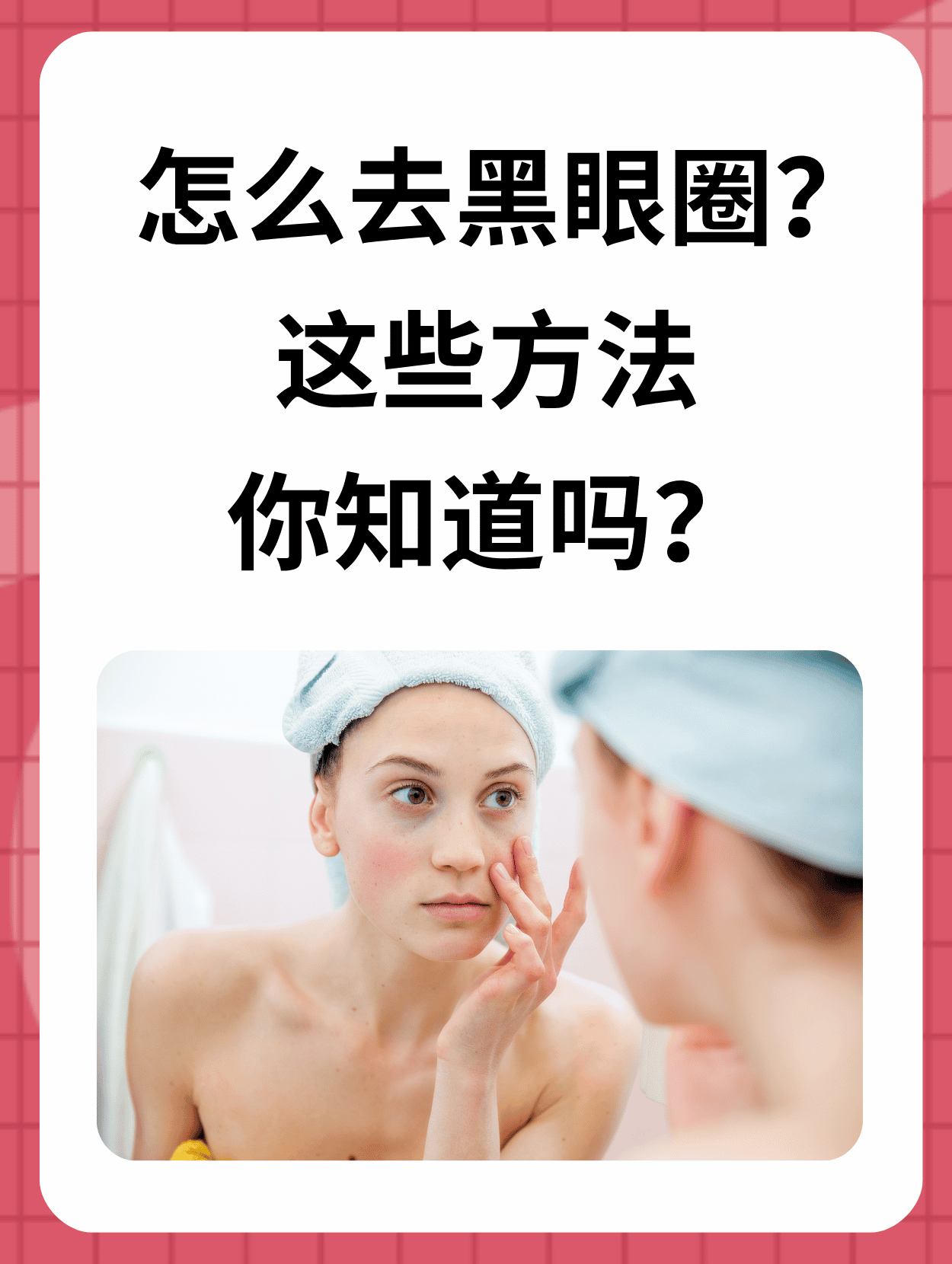 黑眼圈的另一种说法图片