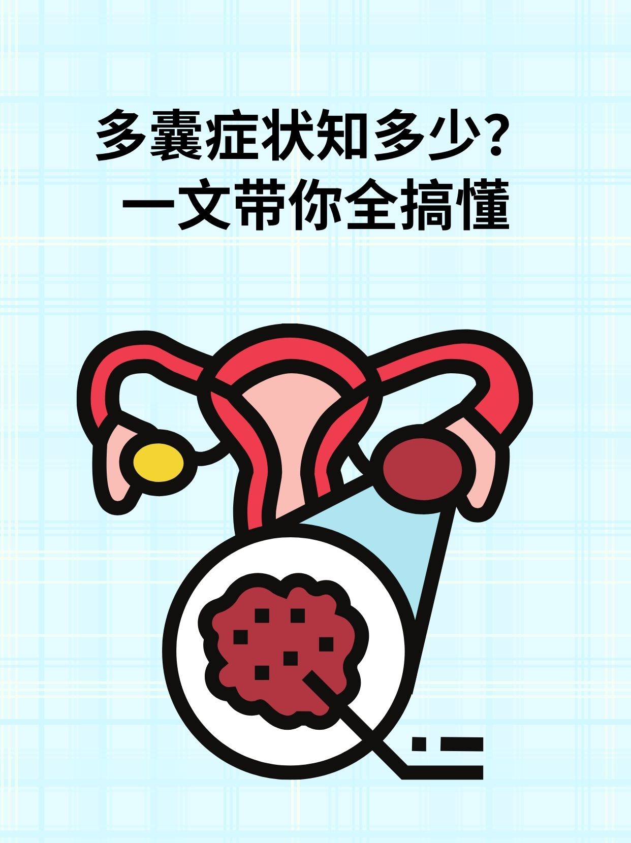 多囊为什么不容易怀孕