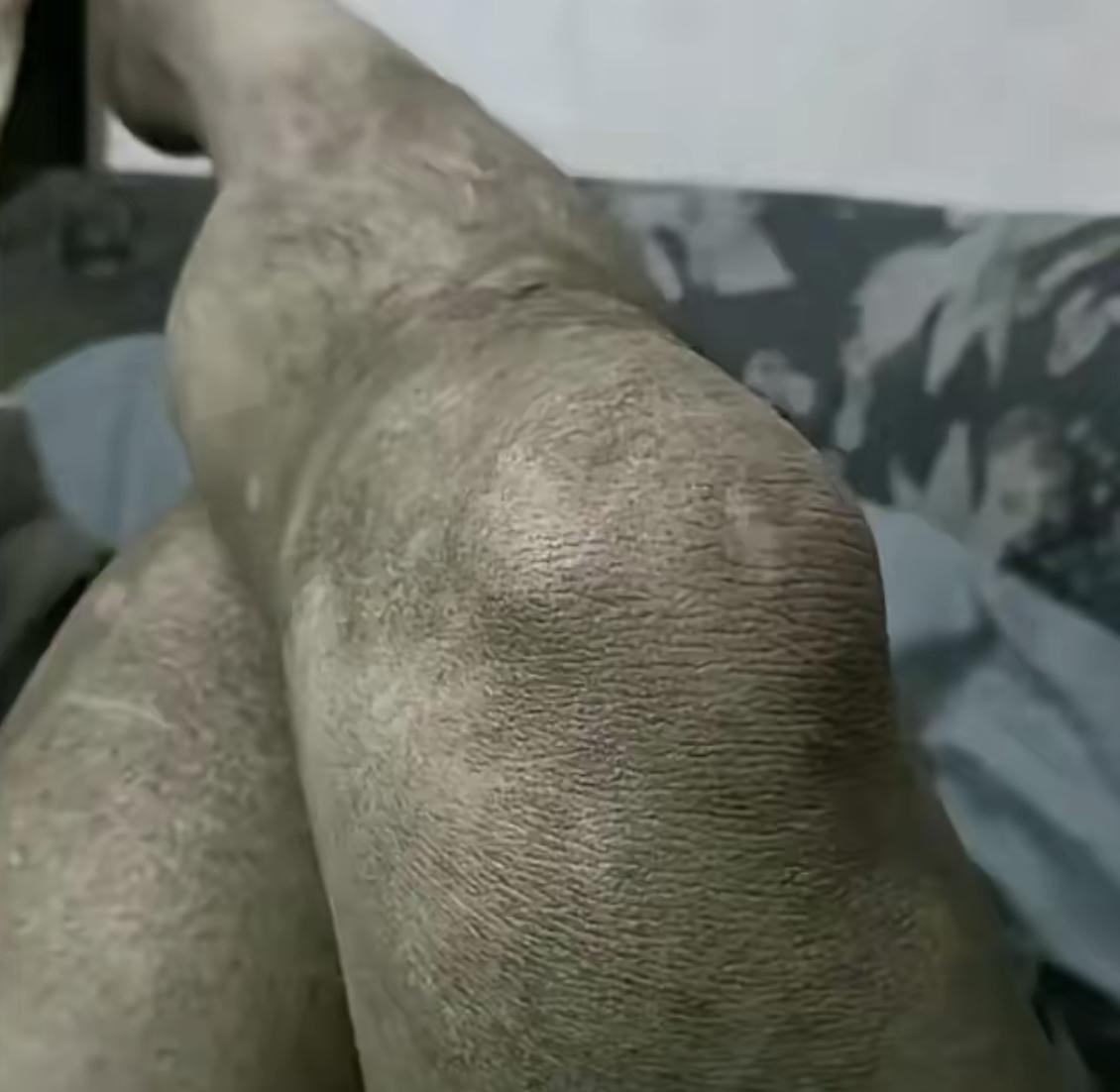 皮肤全是皱皱巴巴像泥土样,你们会可先挂皮肤科?