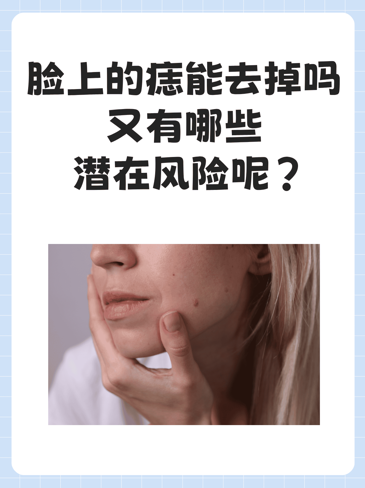 痣,作为皮肤上的一种常见现象,有的痣因为位置,大小或形态让人产闪怂