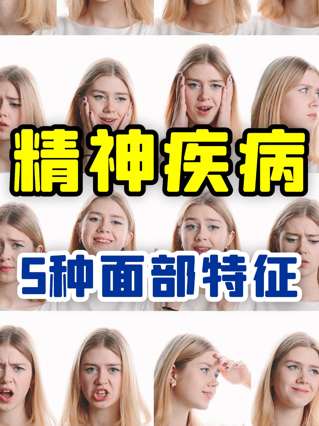 焦虑症 眼神呆滞迷茫 经常烦躁不安 精神分裂症 眼神涣散 面部表情