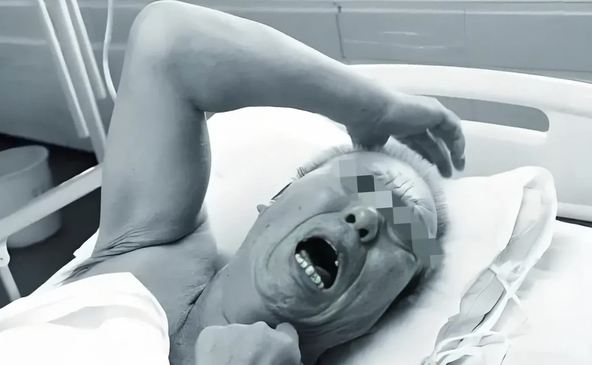 不良事件图片解剖爸爸病人摇晃脑袋撞墙的图片养老院夜里老人惨叫不断