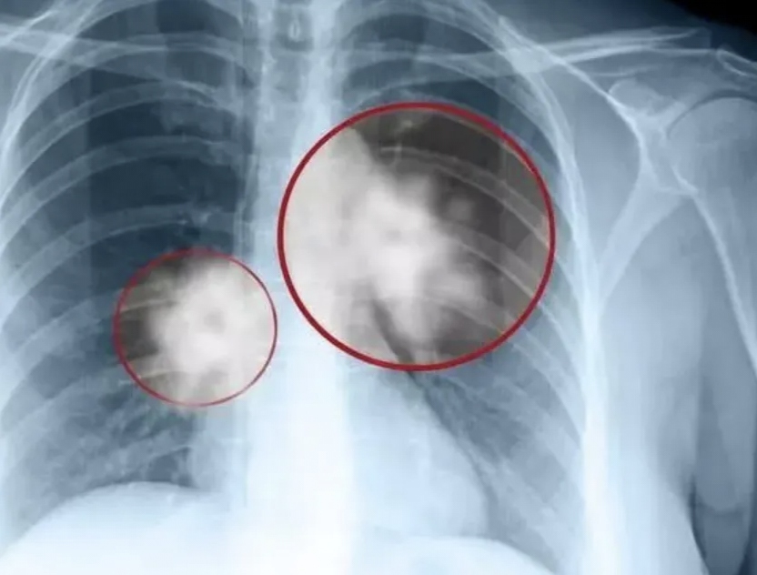 "我真的无法接受,我老公不吸烟,不喝酒,每天早上顺