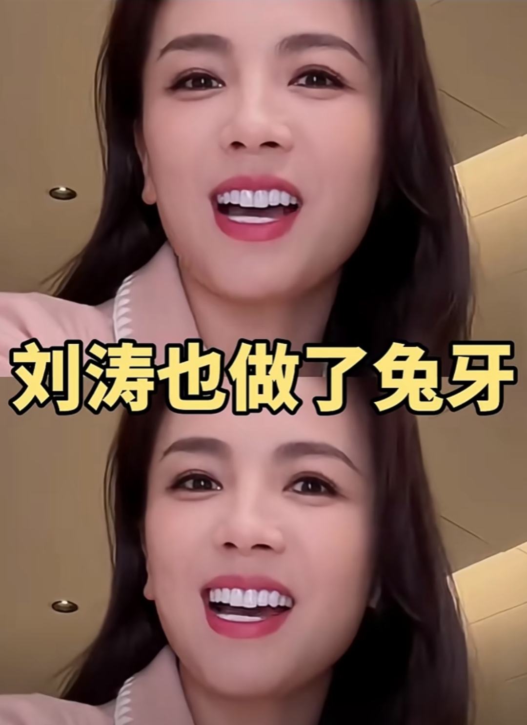 刘涛也做了兔牙,现在流行这个了?