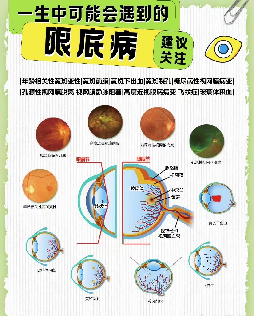 巩膜色素斑怎么消除图片