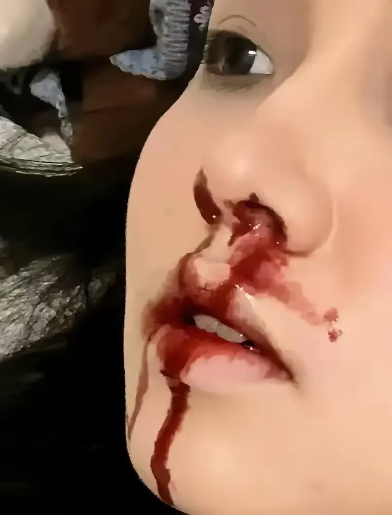刚一月子过去,我就感觉自己快要崩美女吐血死亡美女嘴角流血刀捅女人
