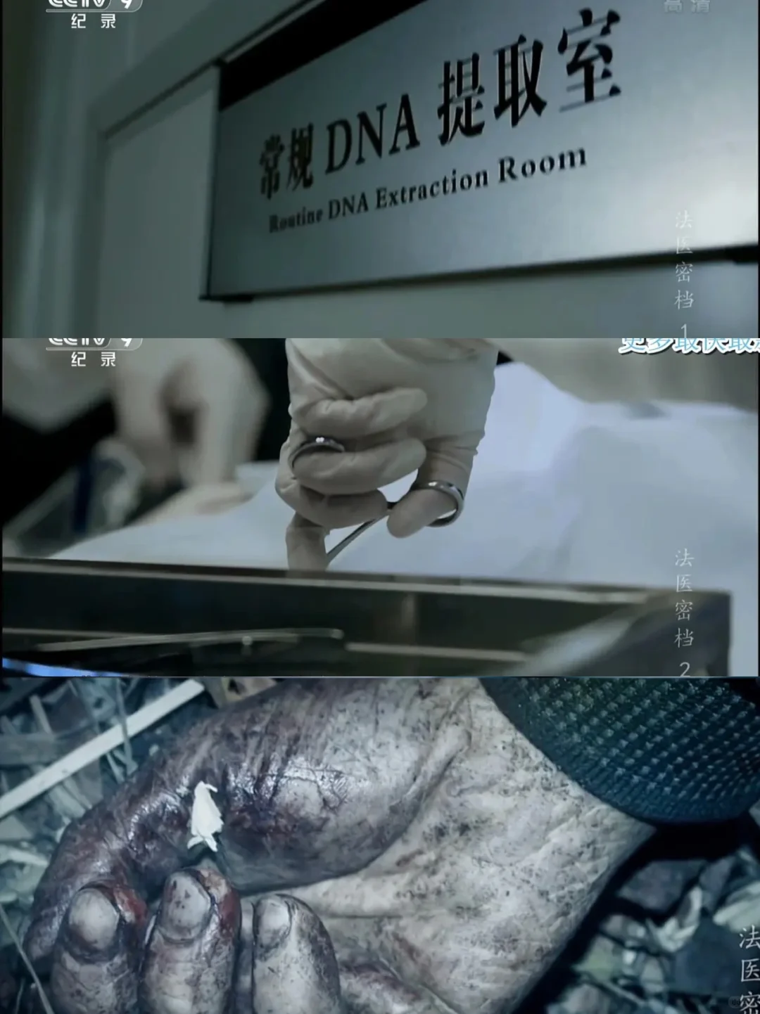 法医经历的真实案件