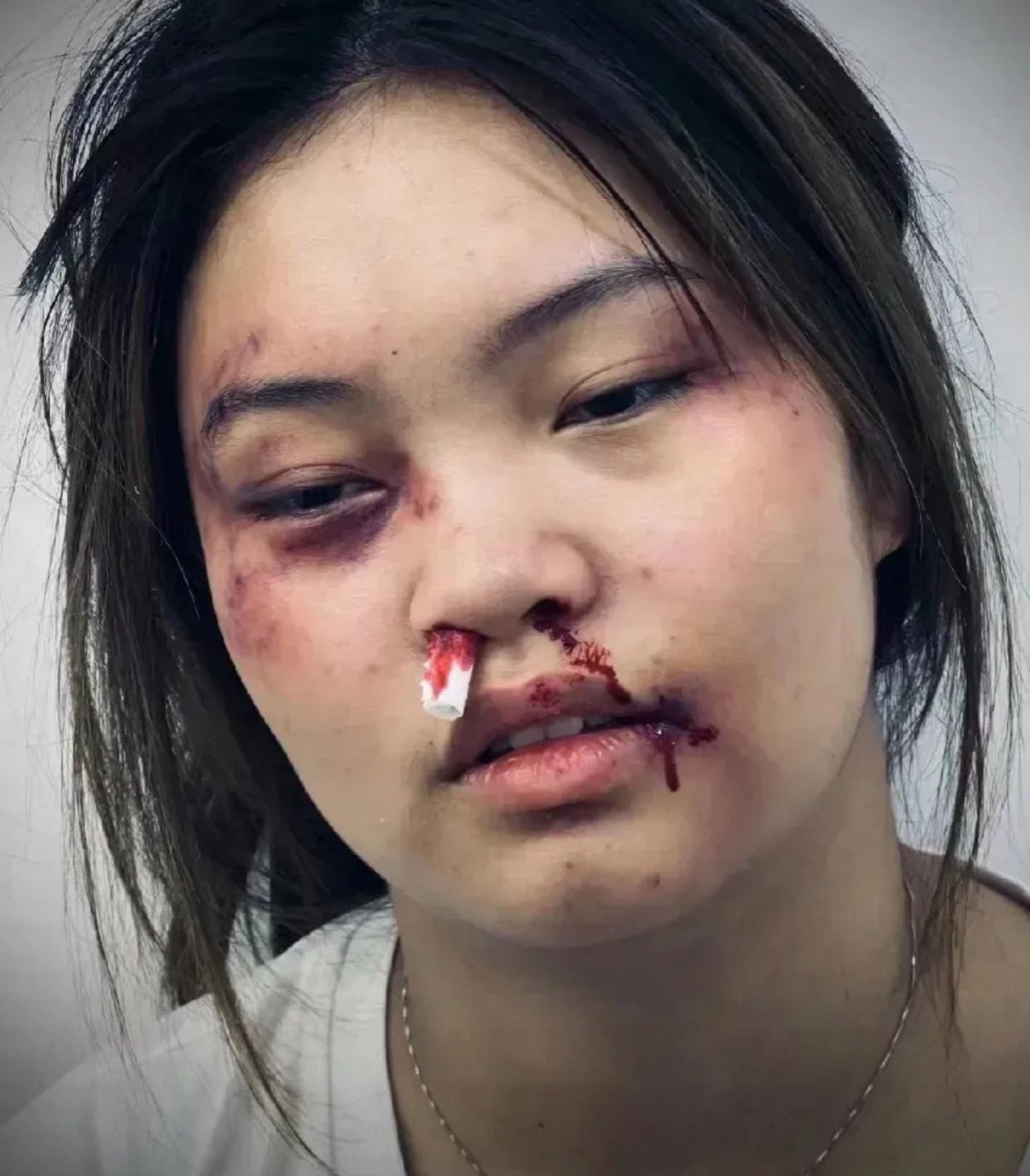 我今天被家暴了,怀孕七个多月的我,被老公打了一顿,我一没哭,二没闹