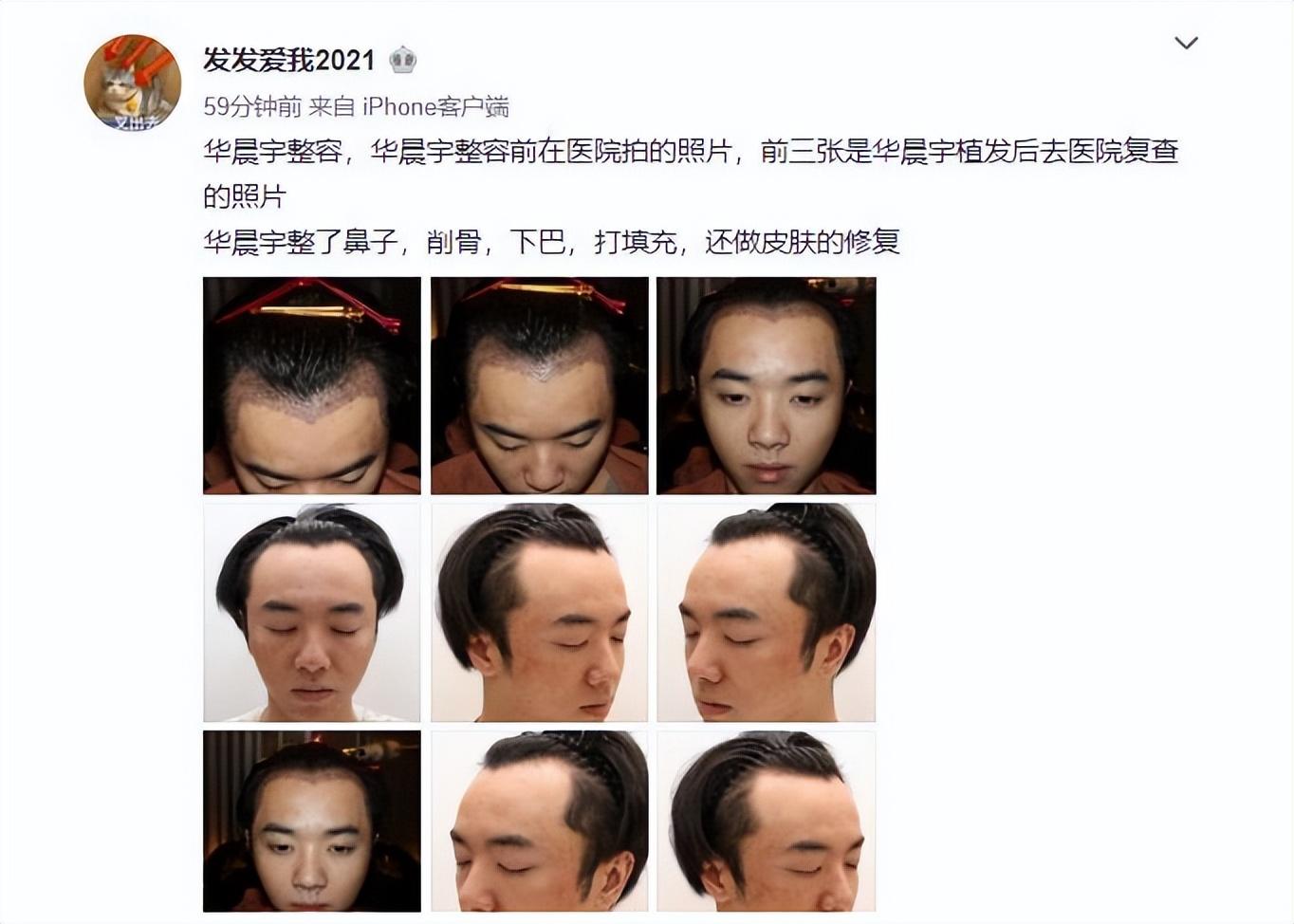 华晨宇