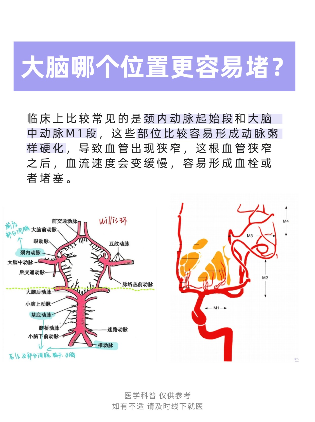 脑血管一旦发生堵塞