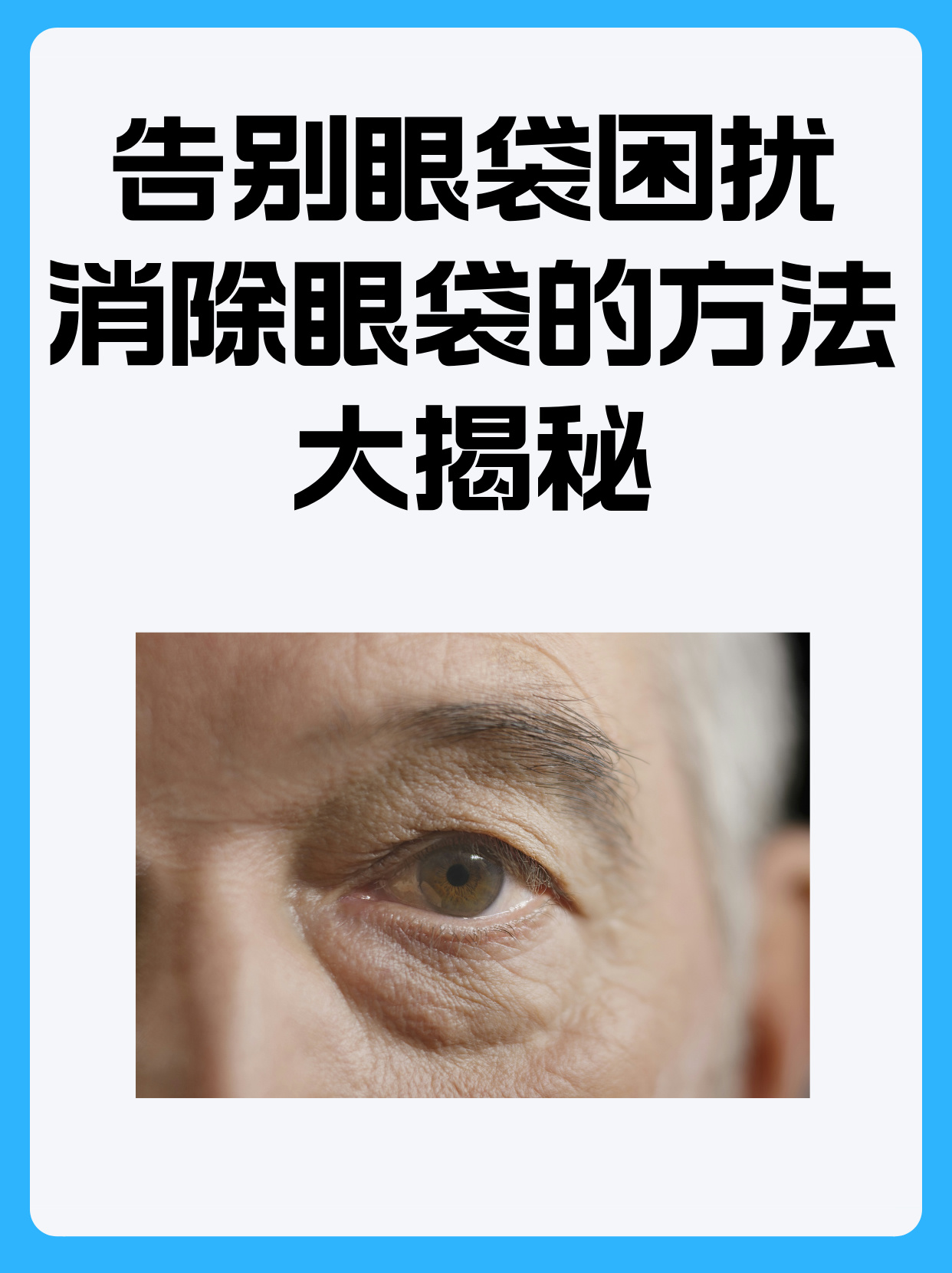 为什么眼袋大?百科在线