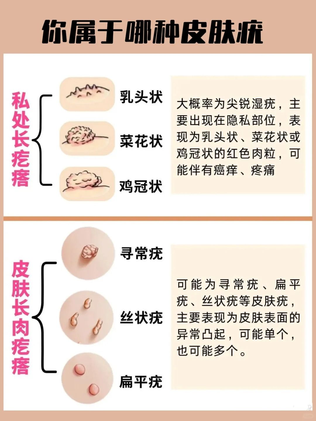 假疣和真疣的区别图女性的简单介绍 假疣和真疣的区别图女性的简单

先容
（假疣和真疣的区别图知乎） 女性