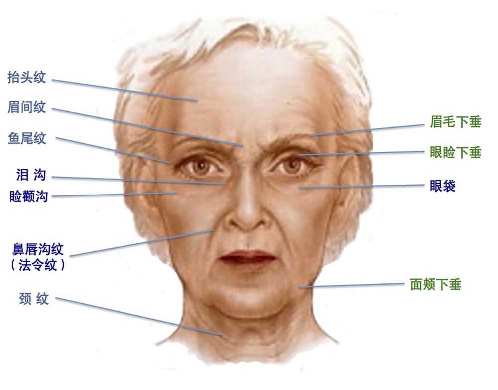 衰老的人来说,真皮层和筋膜层以及肌肉层的变化尤为显著:面部开始松弛