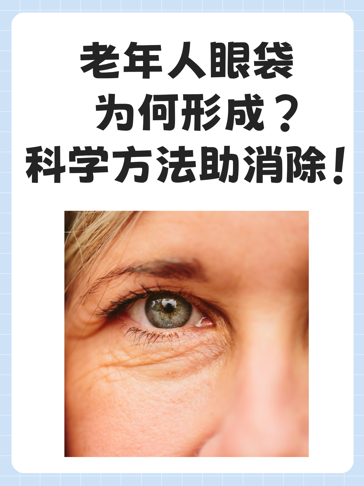 为什么眼袋很重 为什么眼袋很重