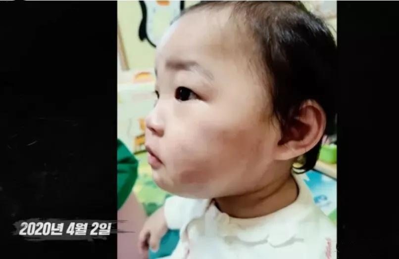 回顾被领养8个月后,她被养父母虐死,肠破骨碎,韩国郑仁案始末
