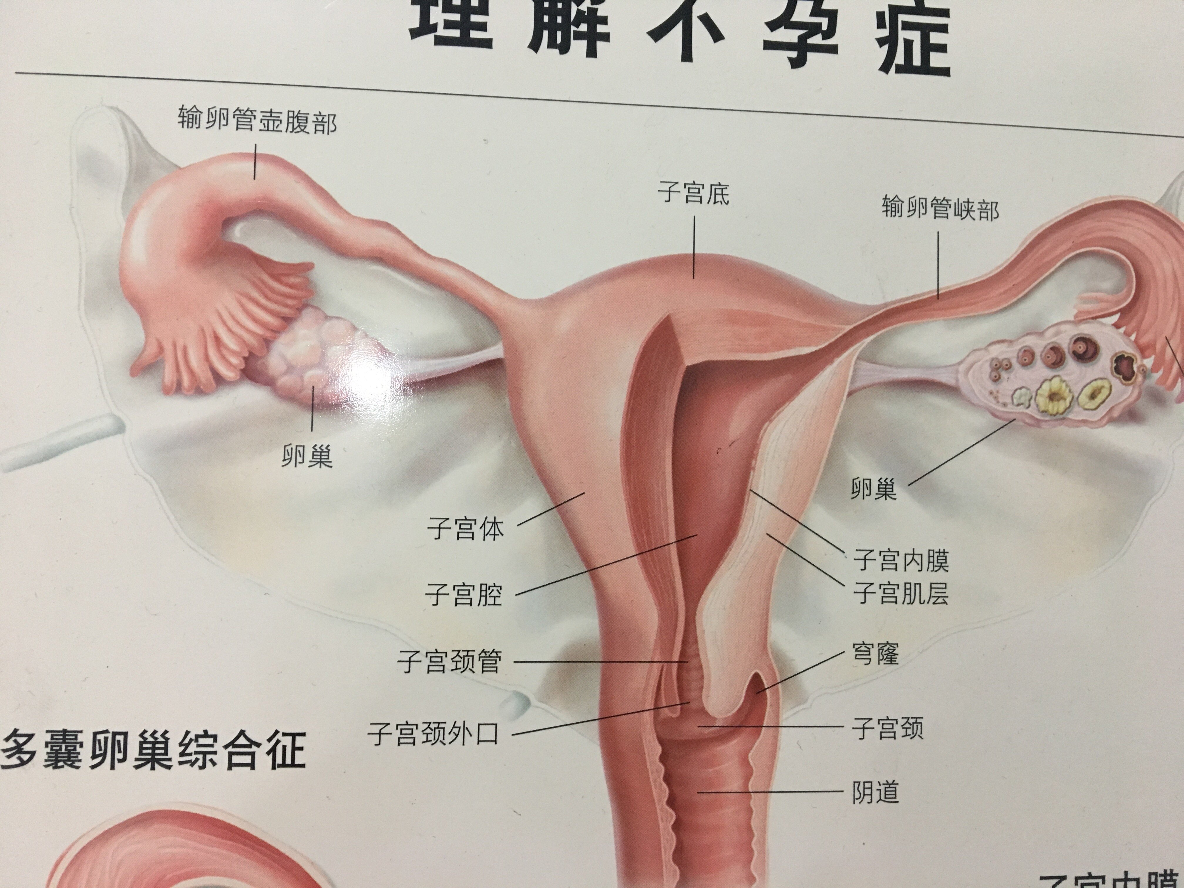 一碗温暖卵巢的汤,远离枯竭,衰老的卵巢,这个方子送给天下女人