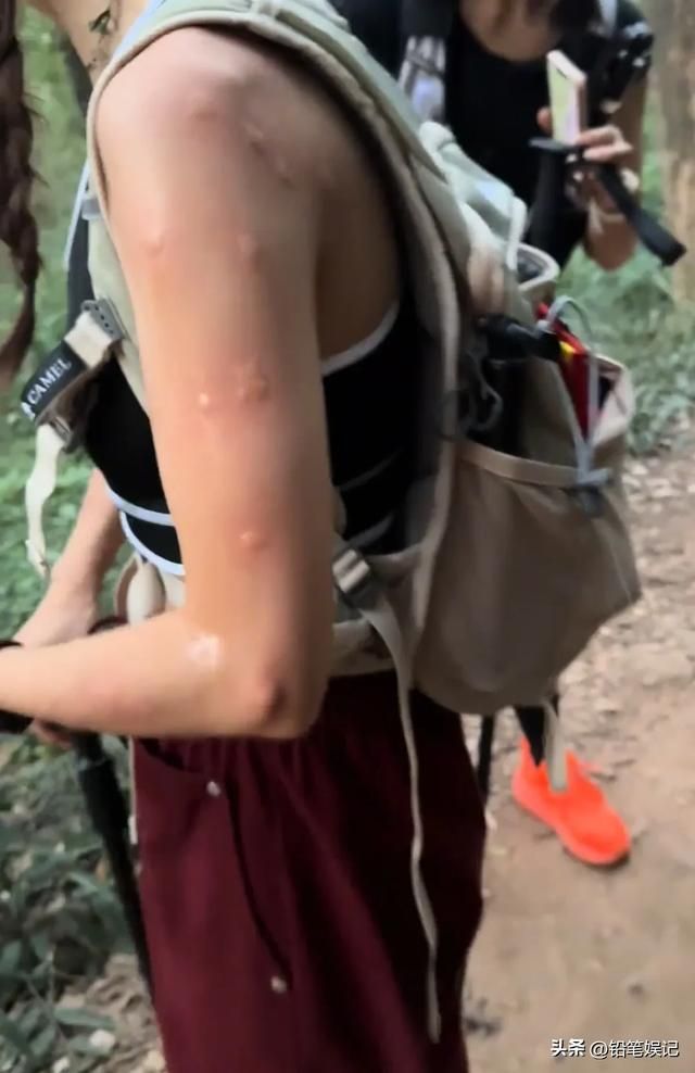 美女徒步长沙岳麓山,穿背心被咬的满身是包,网友:这是真蚊身