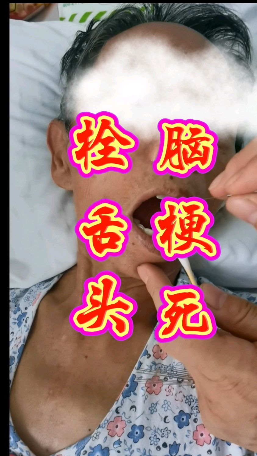 脑梗死后遗症,语音,吞咽障碍