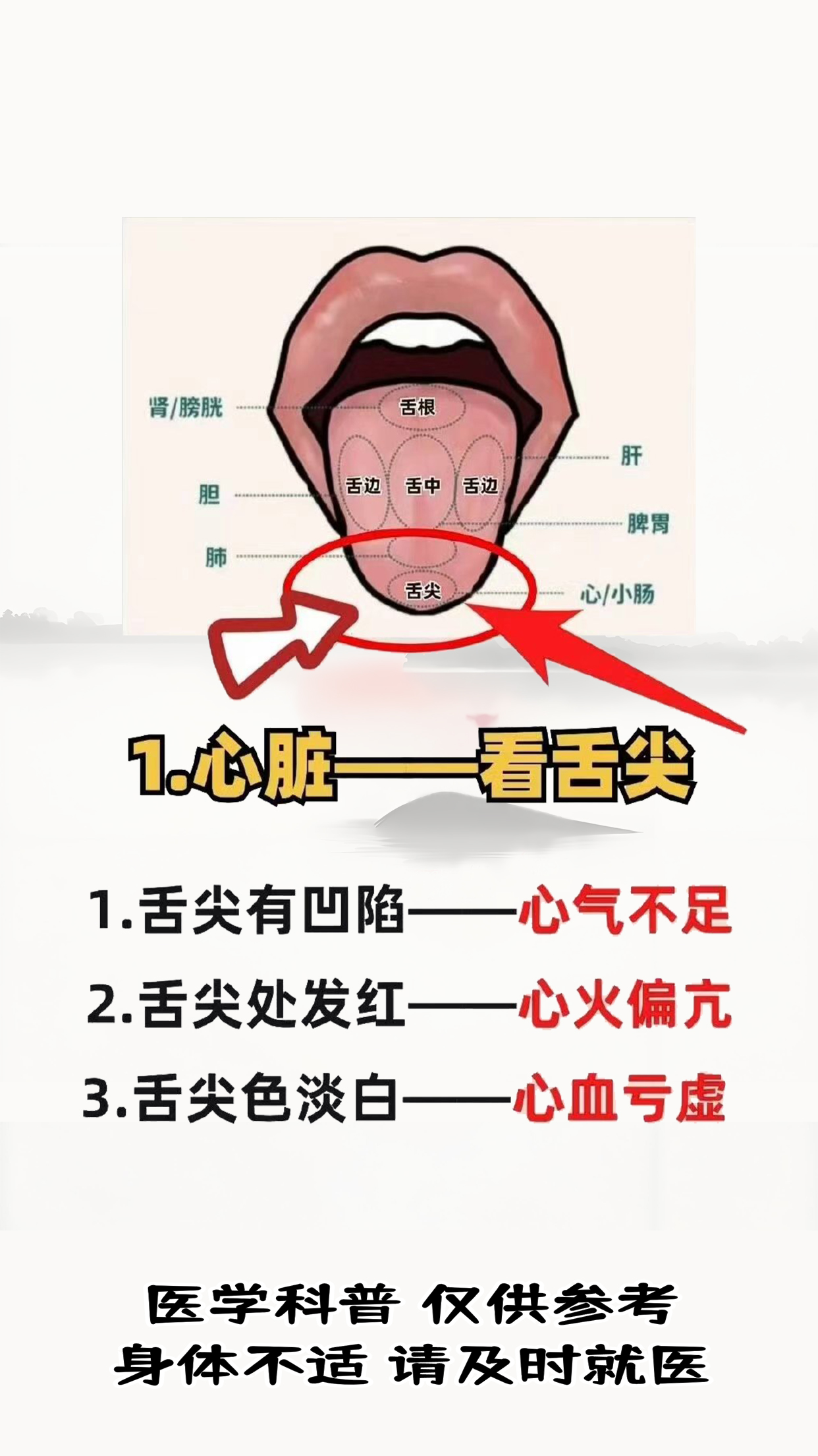 中医看舌象看的是什么?快来学习吧#中医#舌诊#健康