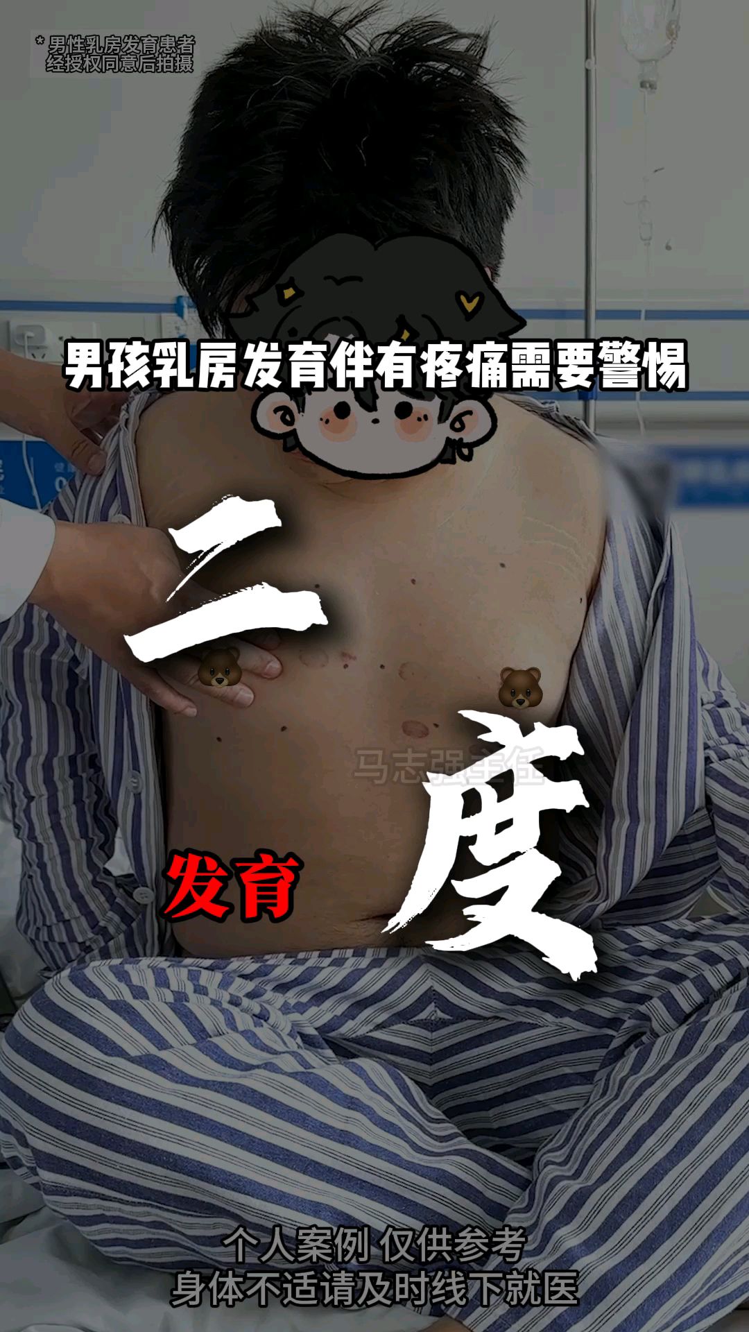 男性乳腺发育要不要紧图片