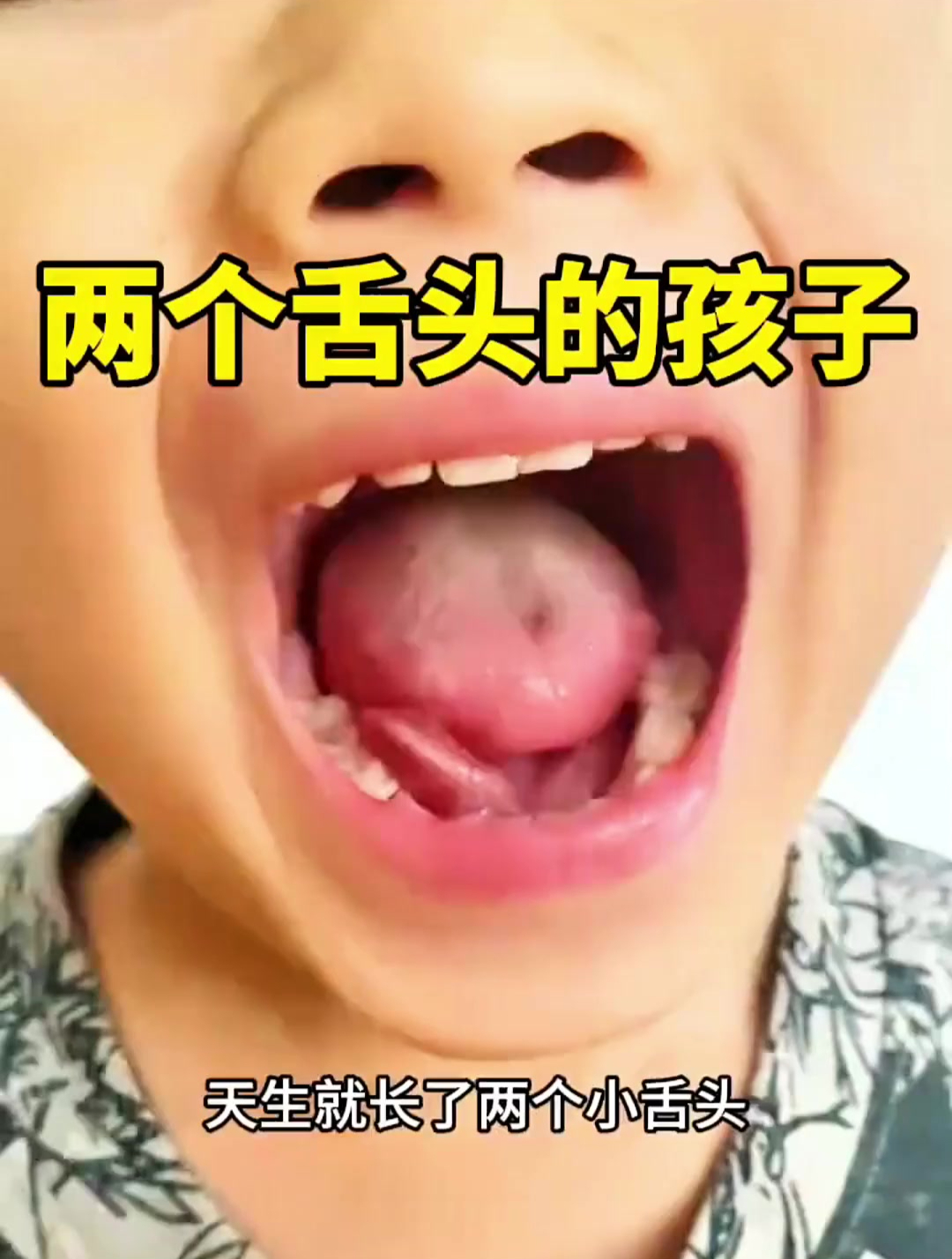 两个舌头的孩子,大开眼界了