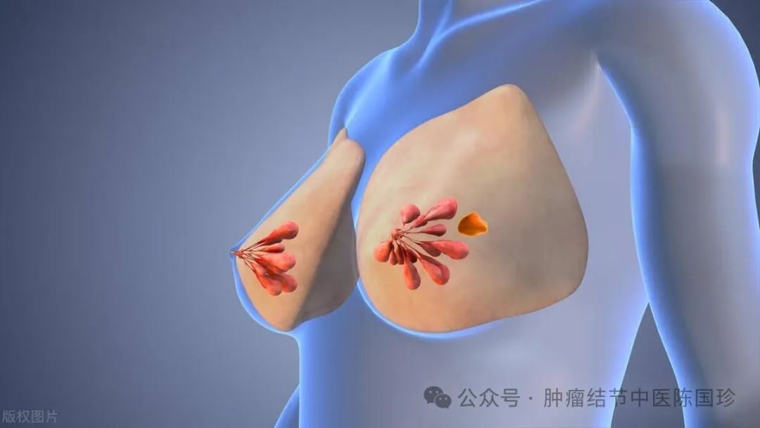 乳腺结节长什么样子图片