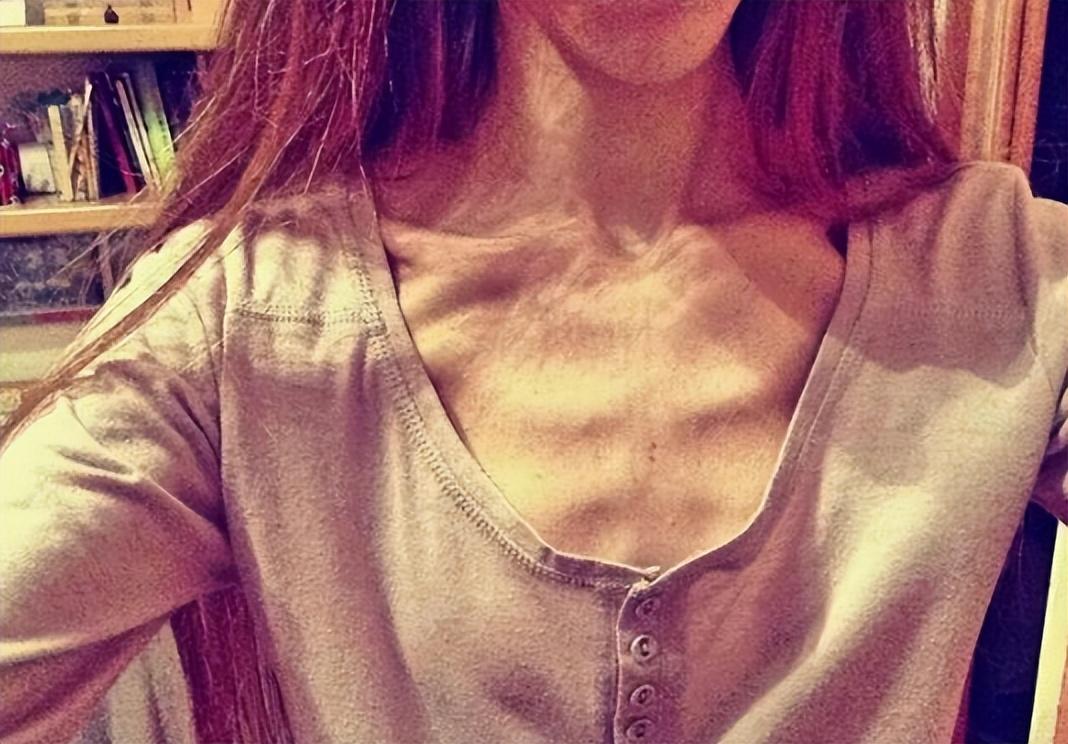 回顾:女孩连续50天只喝水,为爱绝食瘦成48斤,母亲忍痛拔氧气管