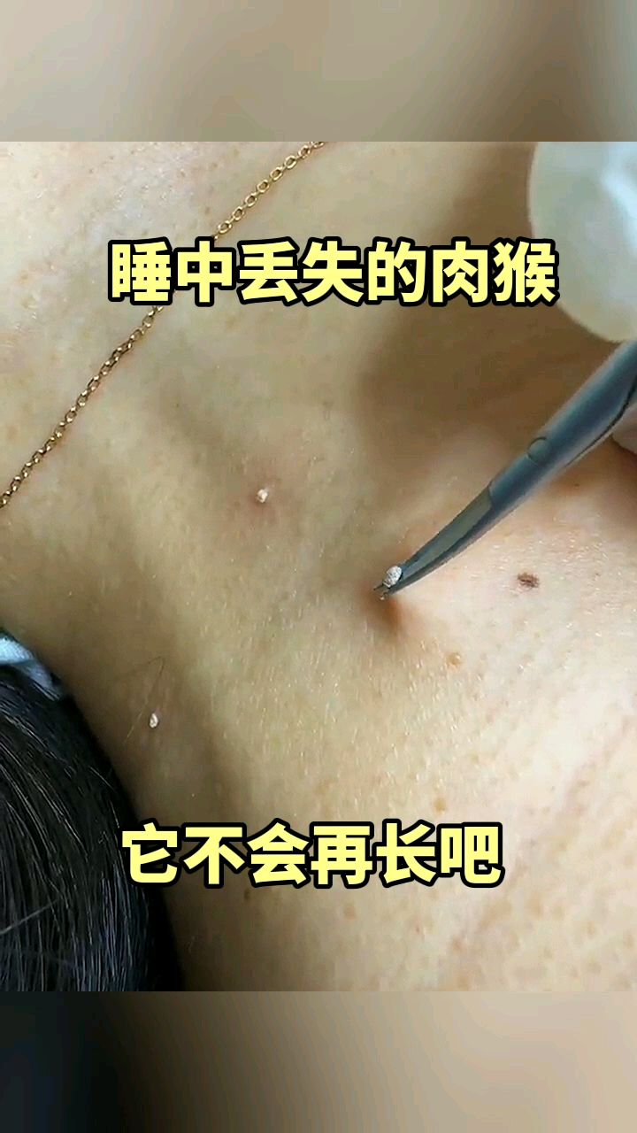 睡中丢失的肉猴,它不会再长吧!