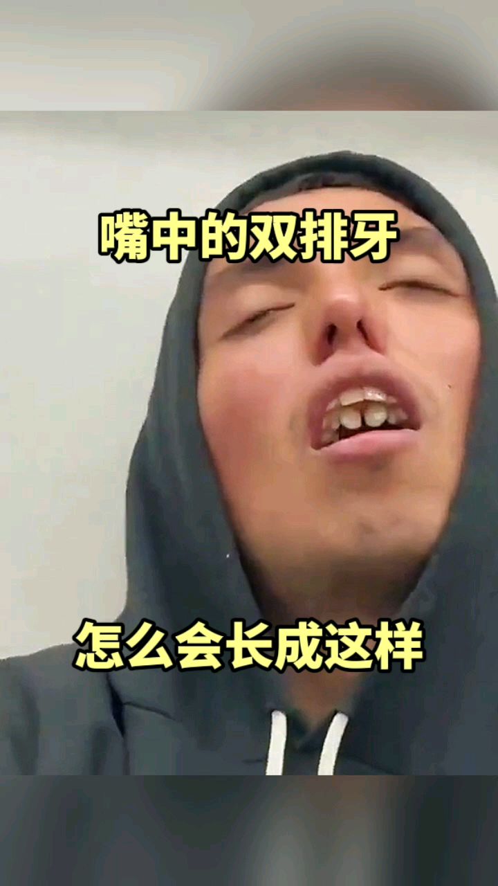 双排牙的危害图片