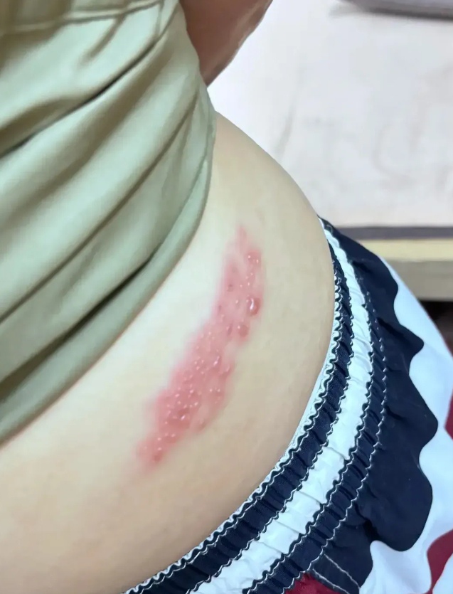 国庆回老家的7天妻子没跟着回去,结果回来她腰上就长