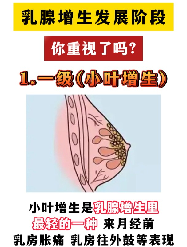 乳腺增生图片图片库图片