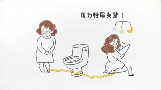 压力性尿失禁?咋回事?咋解决?
