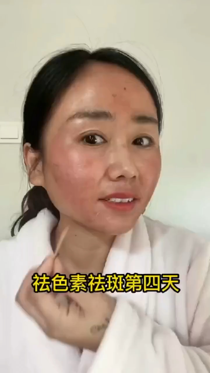 记录自己在家祛斑的第4天,第一次鼓起勇气尝试!爱美之心皆有