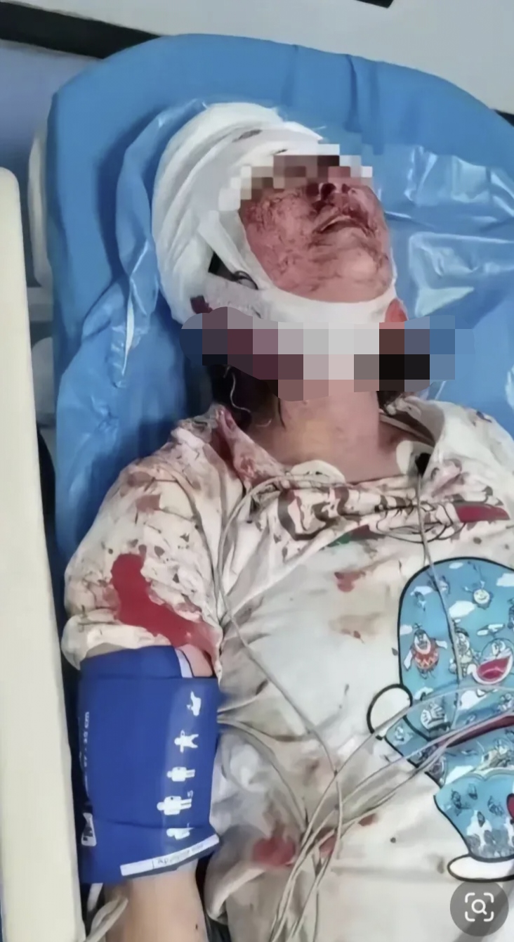 广西一名女子点外卖,因下雨天路滑导致外卖洒出,女子