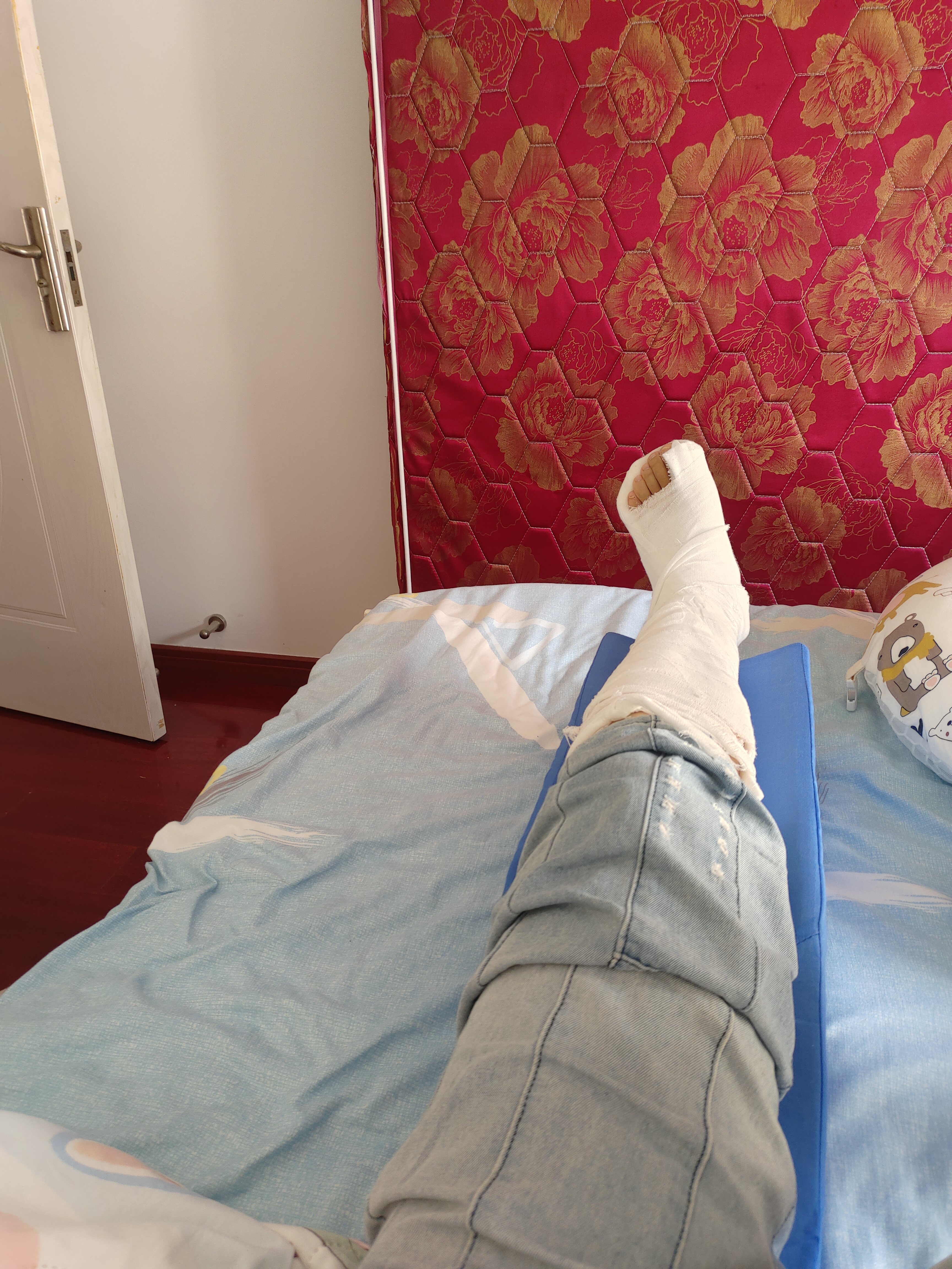 国庆假期,别人都在玩的时候,我崴脚骨折了,打了石膏,今天去复查片子