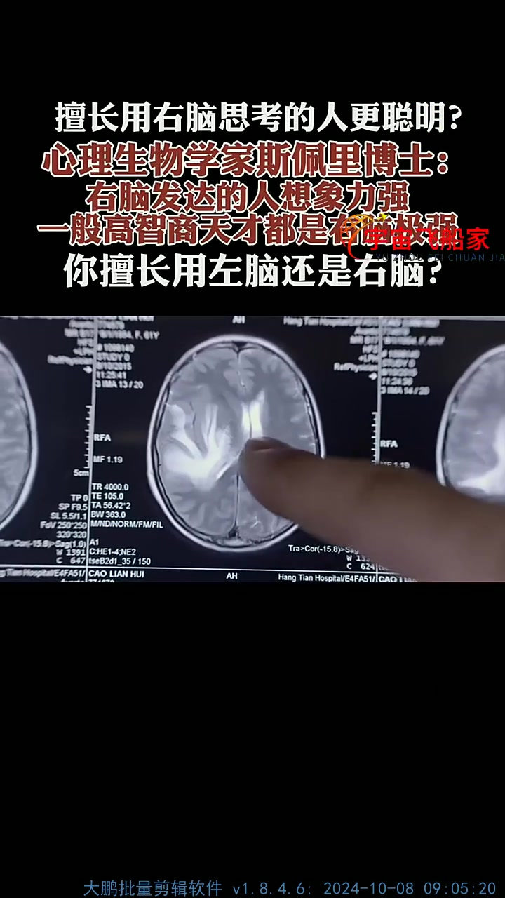 擅长用右脑思考的人更聪明_心理生物学家斯佩里博士 -右脑发达