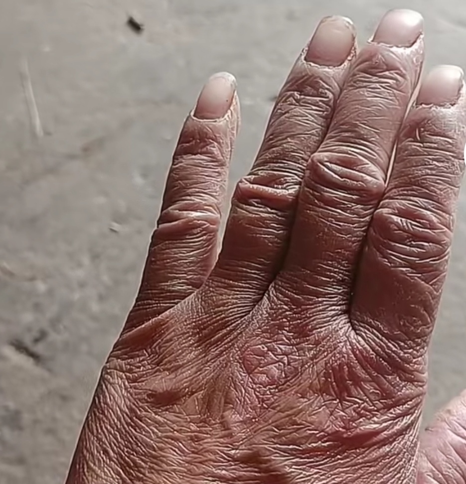 这双手曾在烈日下辛勤劳作,捧起过丰收的喜悦;曾在寒夜中为家人缝补