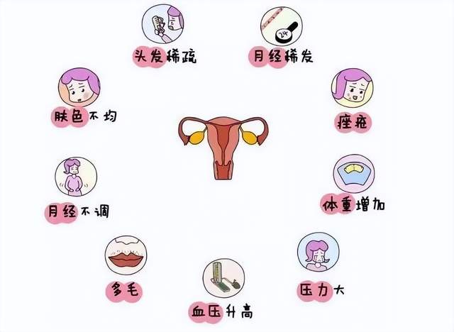 卵巢多囊是什么原因造成的_双侧卵巢多囊是什么原因造成的  第2张
