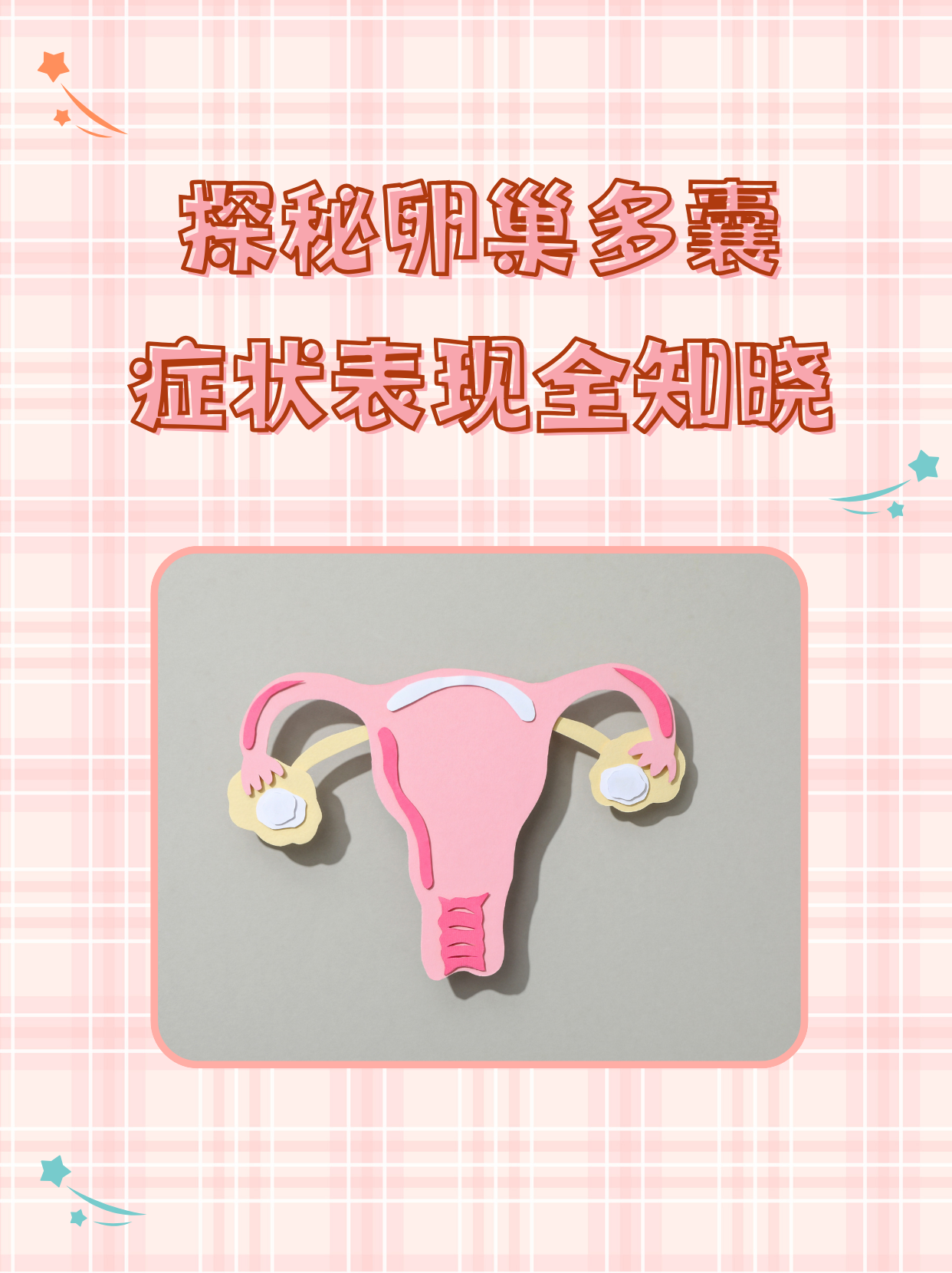 多囊样卵巢综合征(多囊性卵巢综合症要怎么治疗)