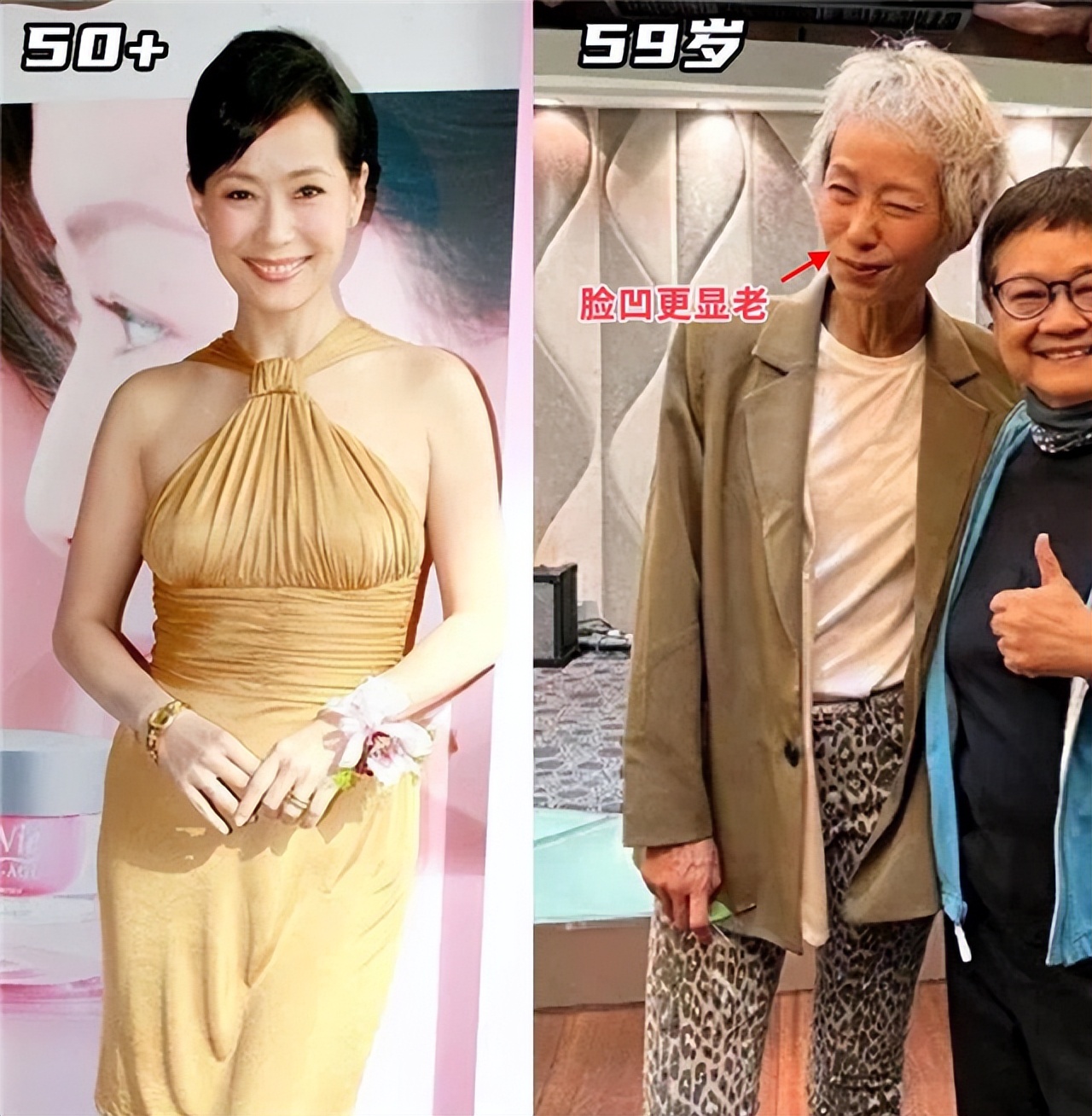 为什么说上了年纪的女人比发腮更可怕的是脸凹?看对比就懂了