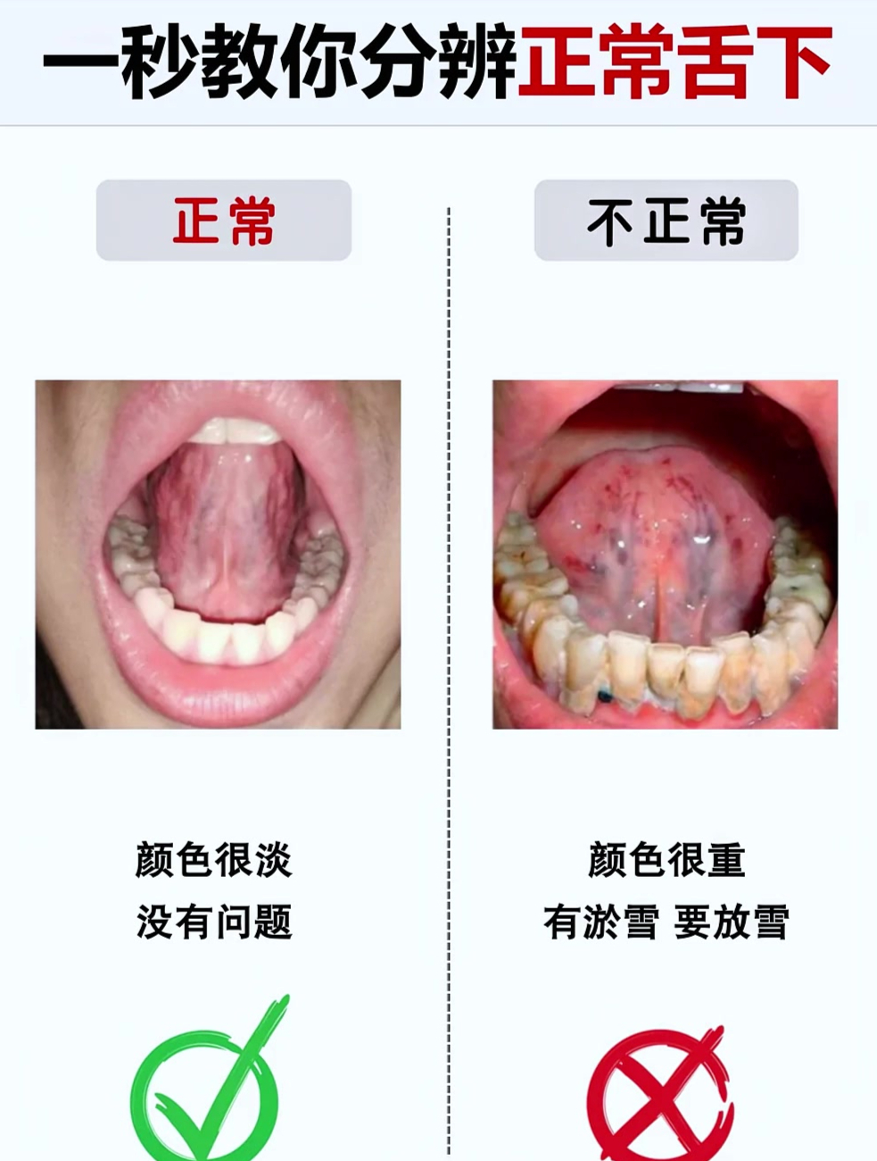我舌头都变紫了,这下是不是要完蛋了?