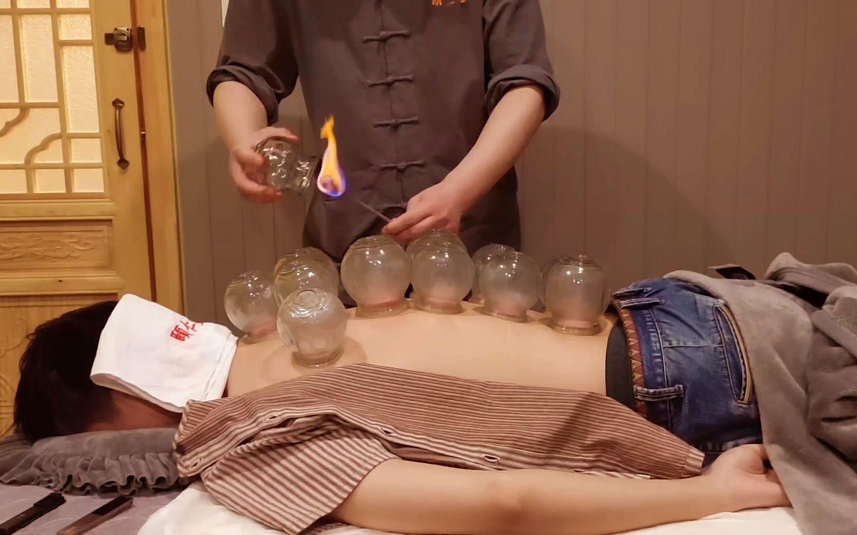 拔火罐吸出来的瘀血是体内的毒素?把实话告诉你,看完涨知识了