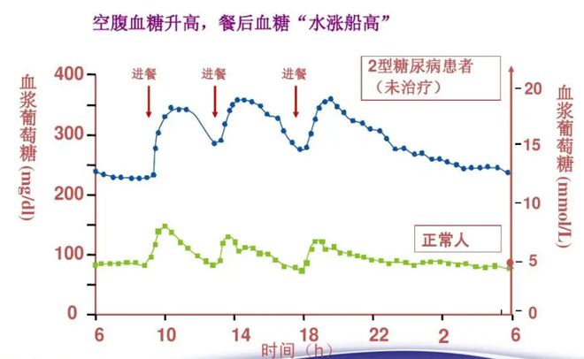 糖尿病餐后血糖曲线图图片