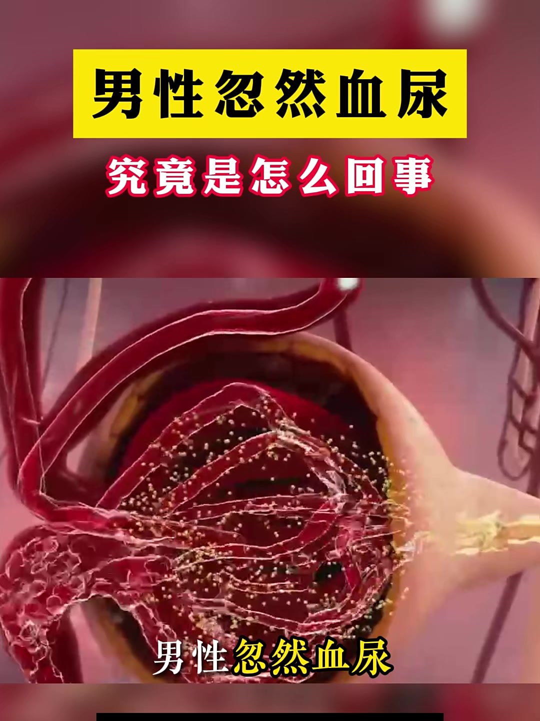 为什么会尿血女性还有刺痛的感觉为什么在线 为什么会尿血女性还有刺痛的感觉为什么在线