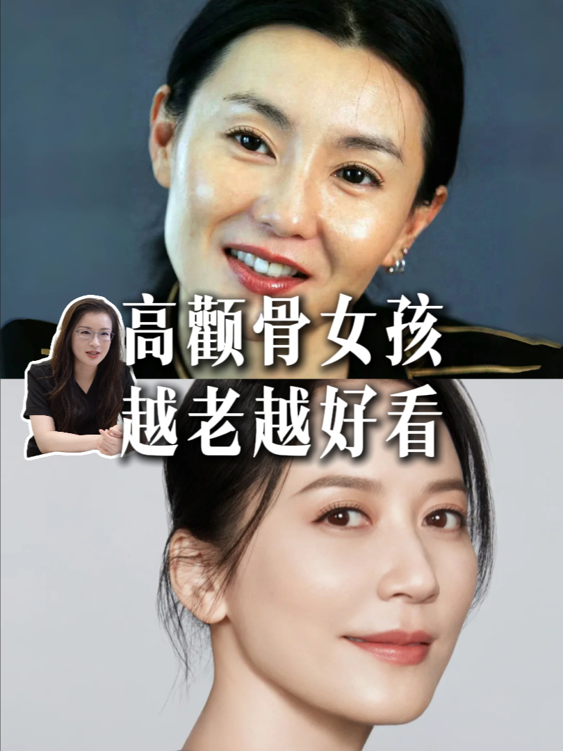 为什么颧骨越来越突出