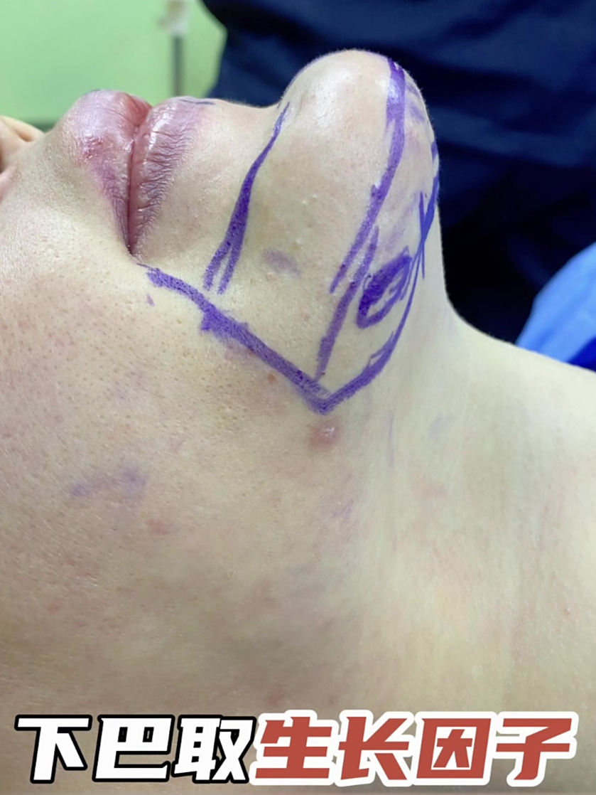 黎星生长因子修复的“稳”,藏在这些你没注意的细节里