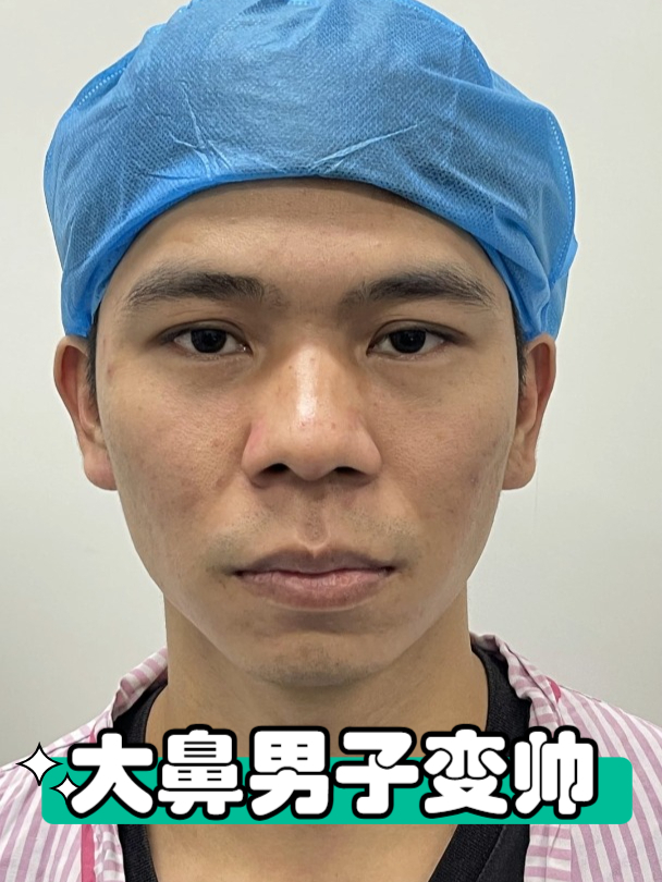 鼻子超大的男生,来这条视频处集合!